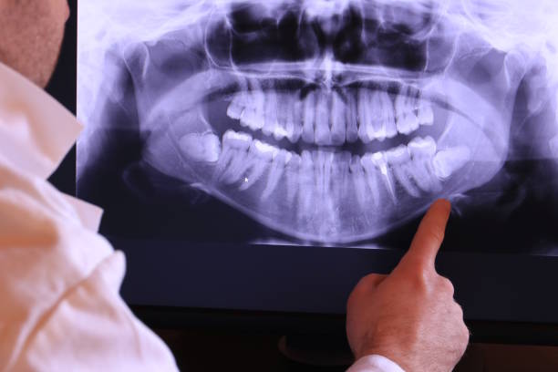 Best Knocked-Out Tooth Emergency  in Port Richey, FL